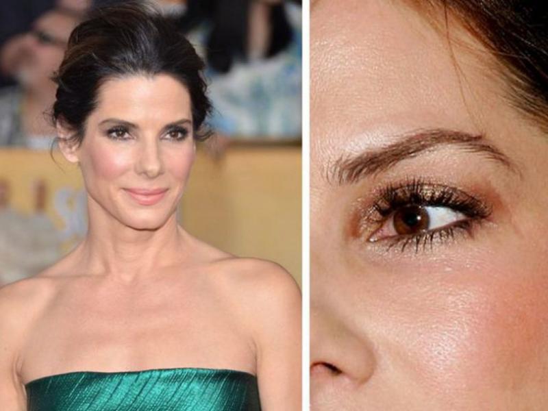 Sandra Bullock's Eye Scar 23